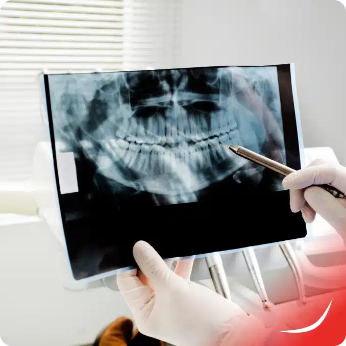 Cost Dental X-Rays